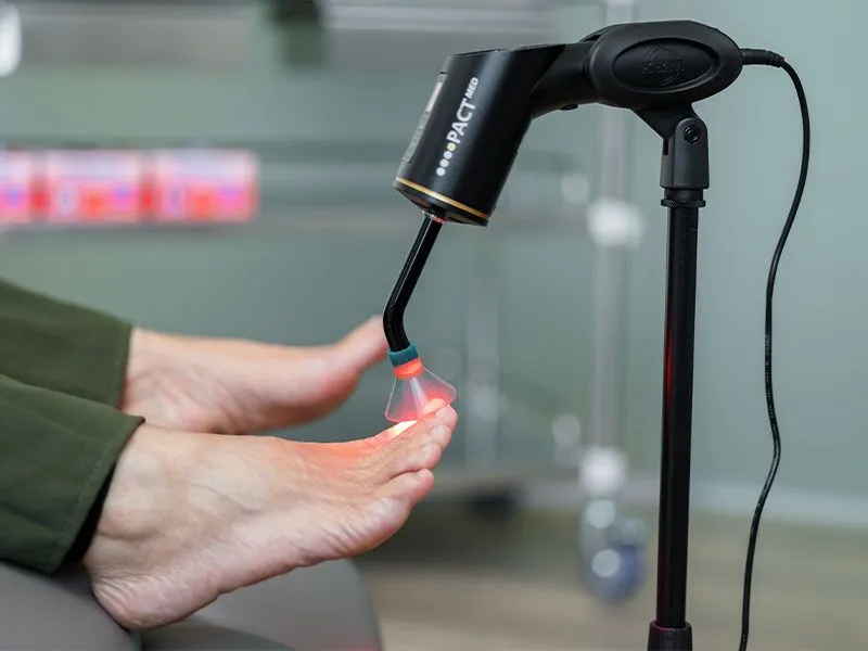 fungal nail treatment with podiatrist PACT light therapy