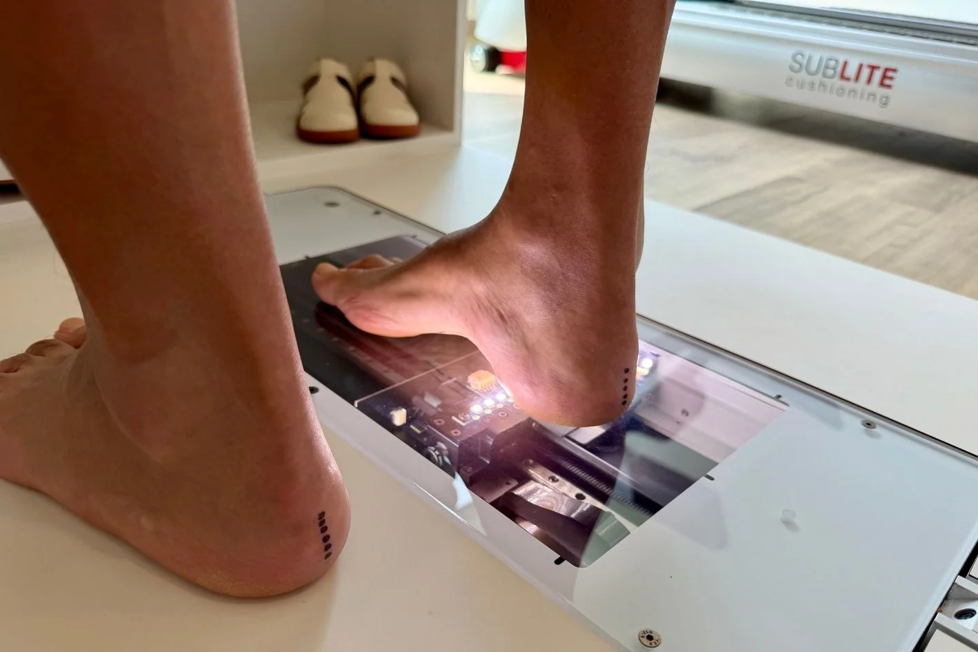 Patient with high arch feet (pes cavus) on a foot scan