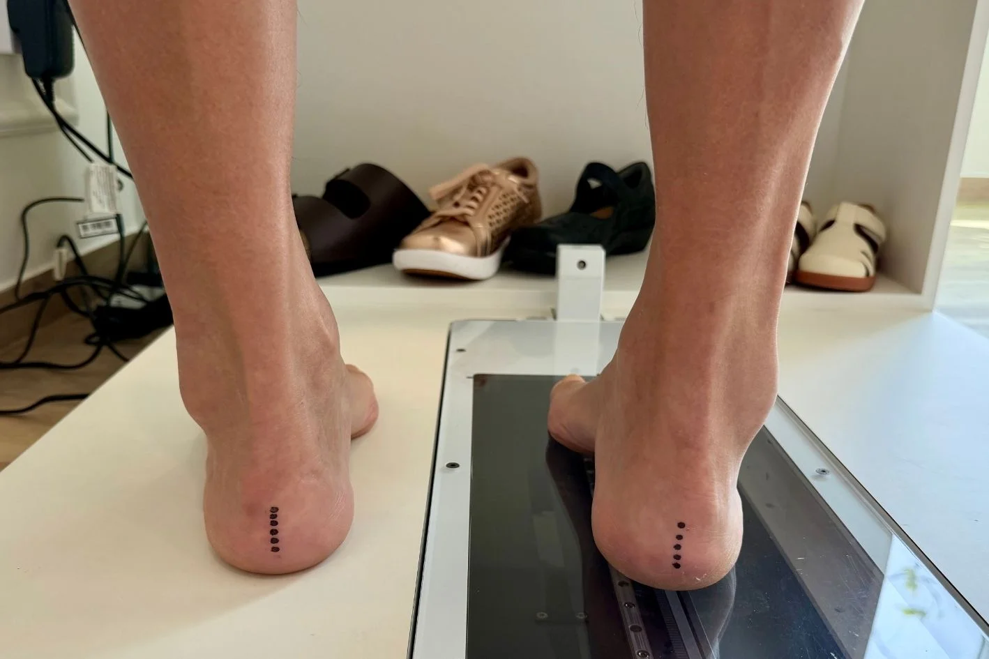 man with pes cavus foot examined using a foot scanner at Straits Podiatry