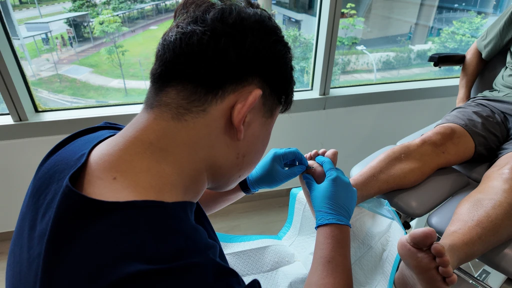 Straits Podiatry 海峡足科的足科医师戴着眼镜、身穿深蓝色制服并戴着蓝色手套,在窗边一手托住患者足部,一手用小刀片处理脚趾部位。