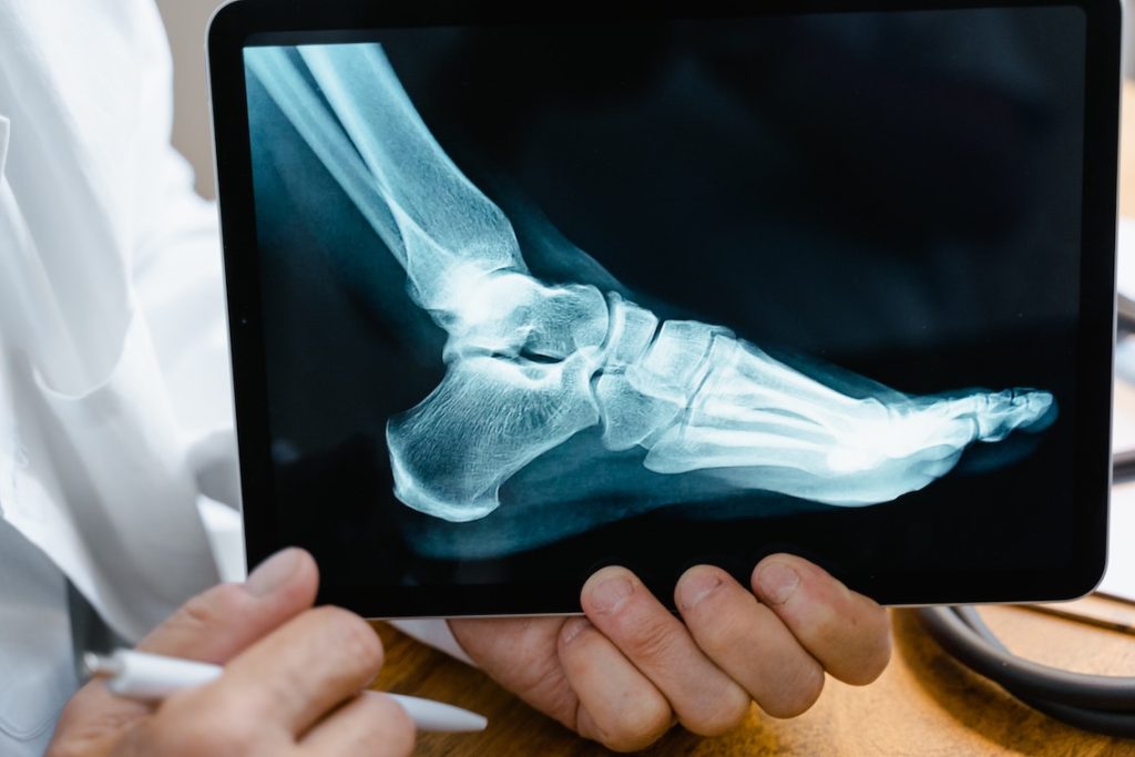 Is Podiatry Recognised in Singapore? Podiatrist Singapore, Straits Podiatry