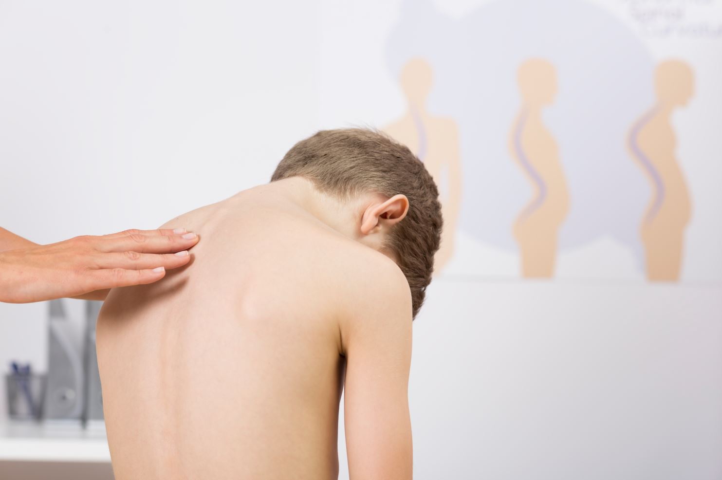 Postural issues in children. 