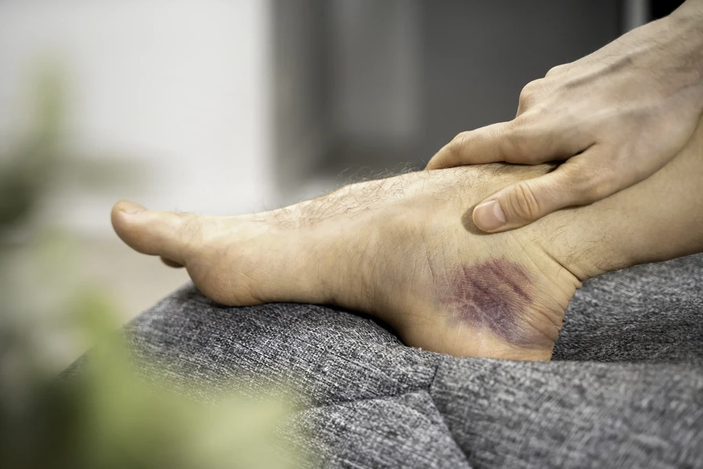 Podiatrist assessing the foot and lower limb to identify factors contributing to Ankle Pain