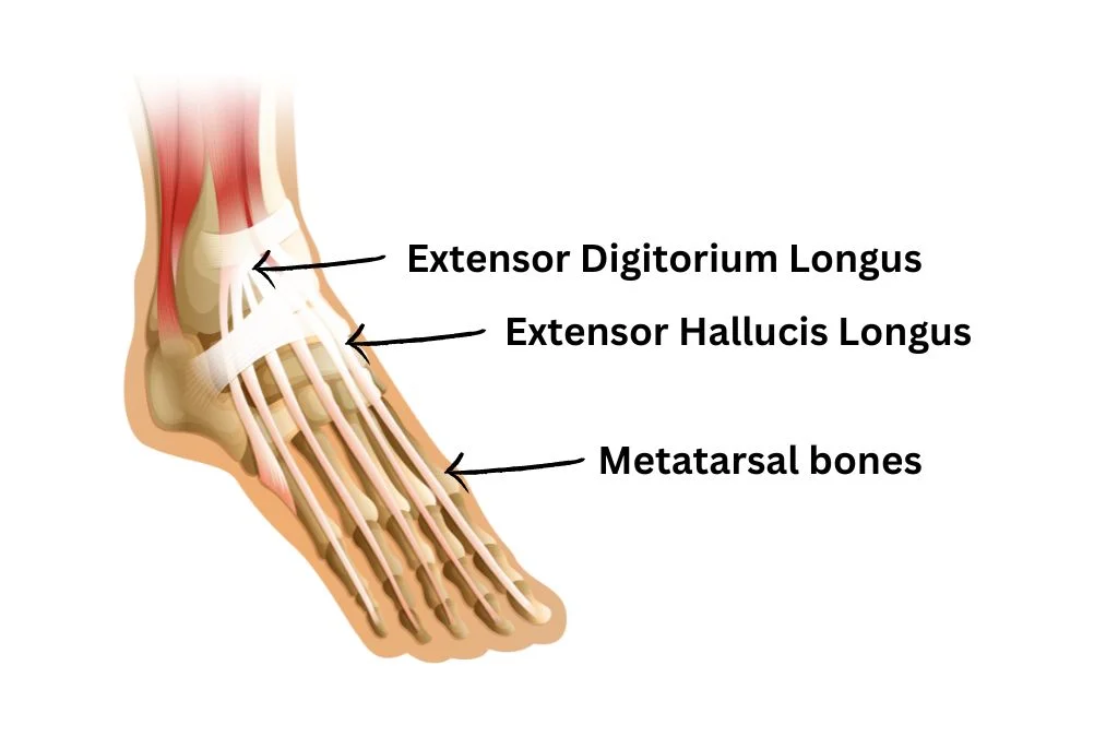 extensor tendonitis causing pain on the top of the foot