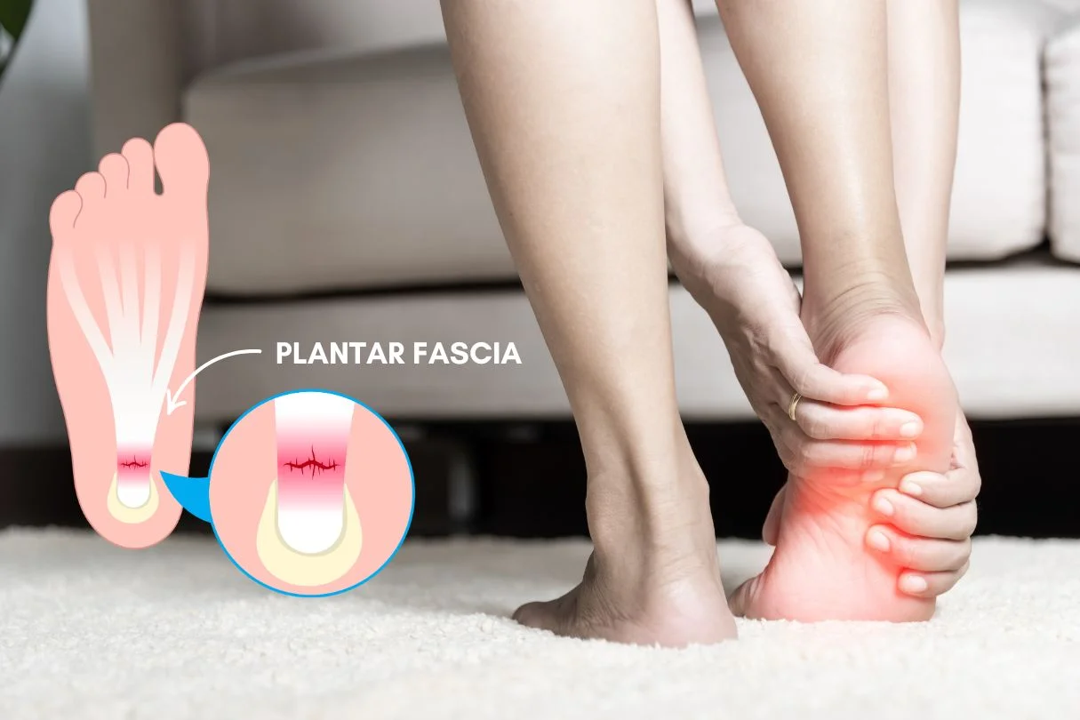 Functions of plantar fascia. Why does plantar fascia becomes inflamed?