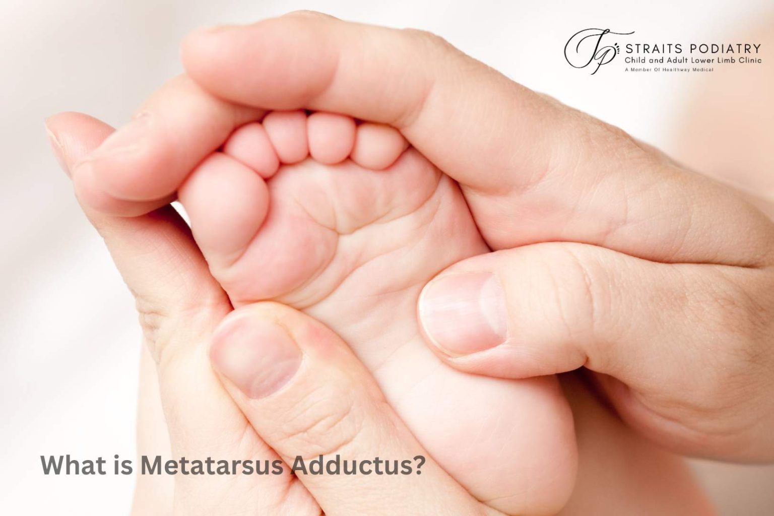 Infant foot with metatarsus adductus