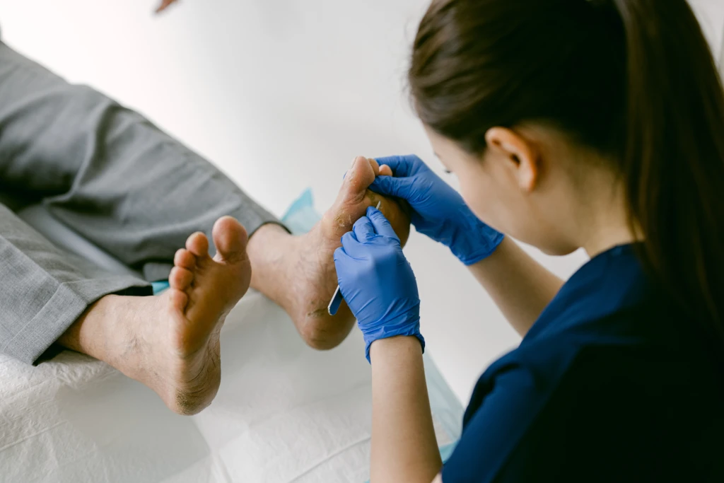A Straits Podiatry podiatrist in navy scrubs and blue gloves uses a blade to perform wound debridement of thickened skin on the sole of a patient's foot.