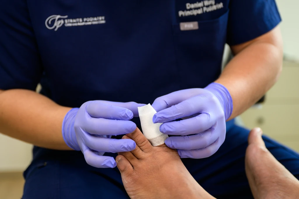 Straits Podiatry 海峡足科的足科医师身穿深蓝色制服并戴着蓝色手套,用刀片对患者足底增厚的皮肤进行伤口清创。
