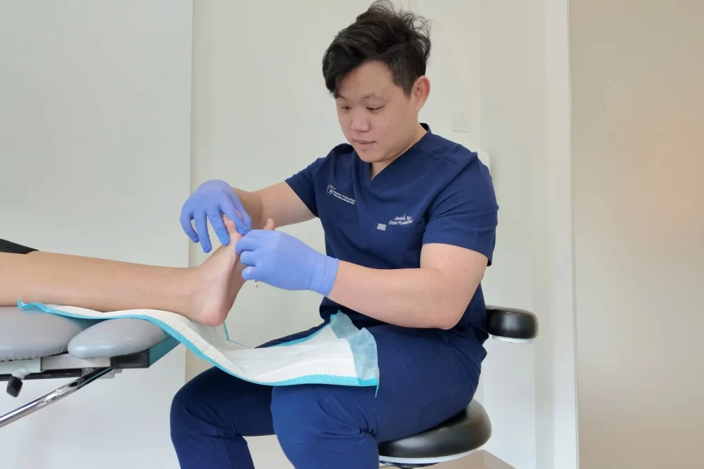 Podiatrist debriding the callus from wart before cryotherapy