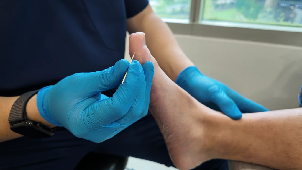 Gloved podiatrist hands hold a thin wooden probe against a patient's big toe to test skin sensation during a diabetic foot check.