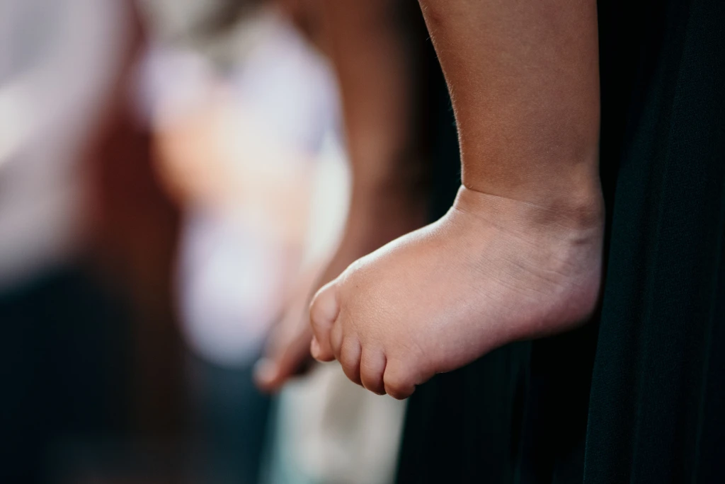 Illustration showing the affected area in Curly Toes