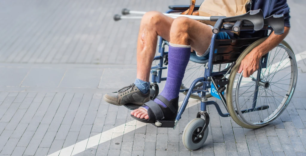 A person in a wheelchair outdoors with one leg in a purple cast and black offloading cast sandal, crutches nearby, the weight relief behind why offloading matters for a diabetic foot ulcer.