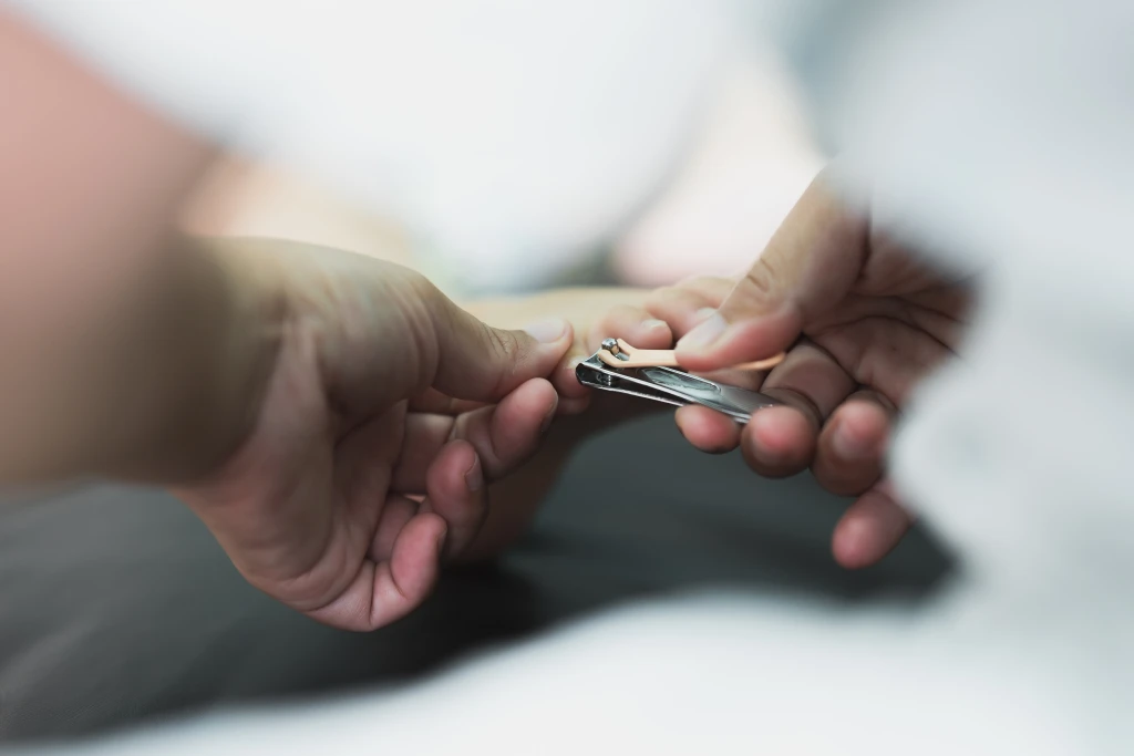 Close-up of two hands using a metal clipper to trim a toenail, the everyday nail care habit central to how to prevent fungal nail infection.