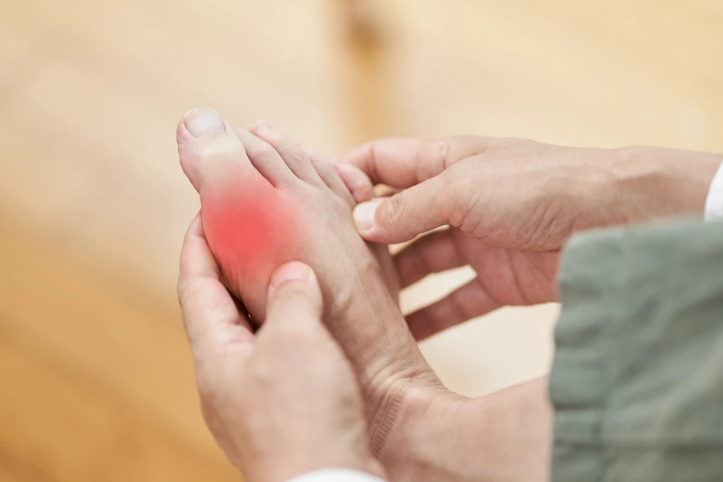 Two hands cradle a bare foot with a red overlay marking pain at the big toe joint, the shared site of bunion vs gout flare-ups