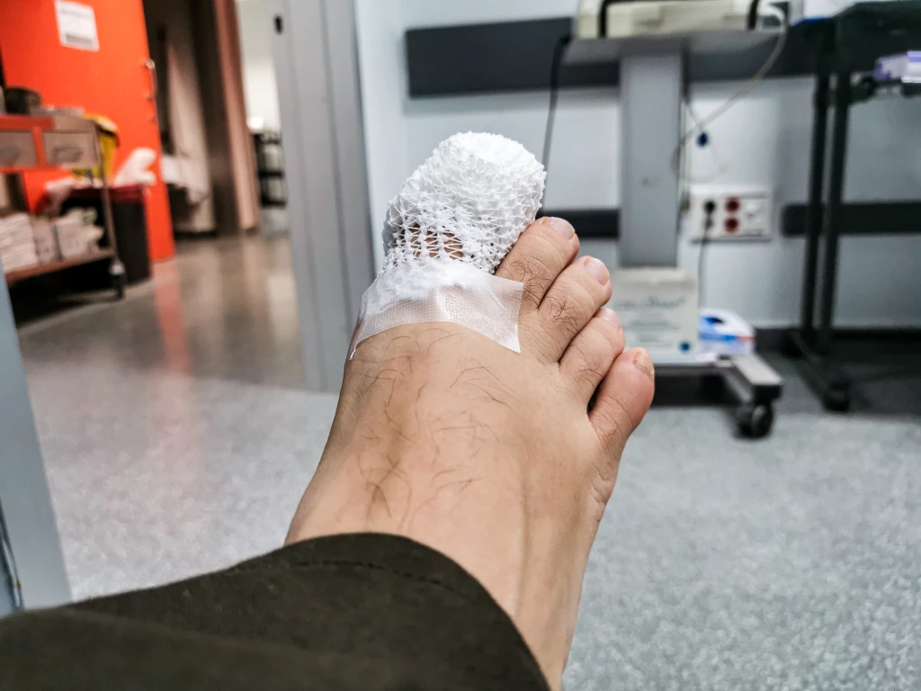A bare foot with the big toe under a white mesh dressing and tape in a clinic, the dressing applied once toenail pain after football is assessed and the nail managed