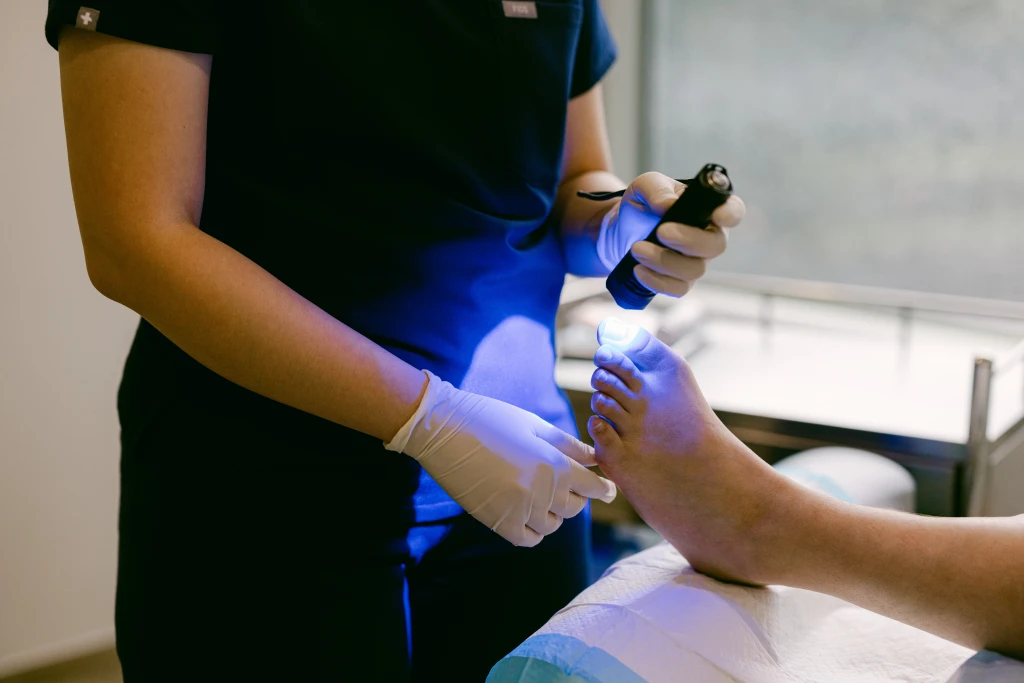 A clinician in scrubs holding a handheld blue curing lamp over a patient's big toenail, the bonded application of nail bracing as an alternative to partial nail avulsion.