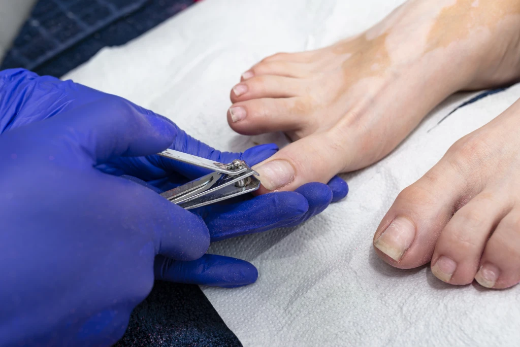 A gloved practitioner trimming a toenail on a patient's bare foot resting on a white towel, one of the routine foot care tips done properly.