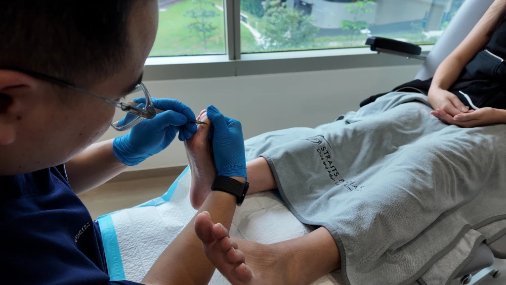 A gloved podiatrist using a fine instrument on a patient's toenail in a clinic chair, the professional alternative to looking up how to dig out a corn on foot.