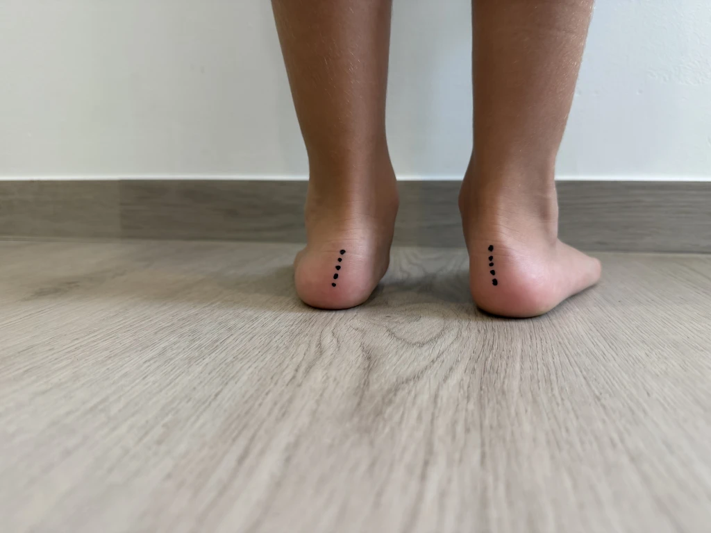 Rear view of two bare heels on a wooden floor, each marked with a vertical row of ink dots, an alignment test for how to know if you have flat feet.
