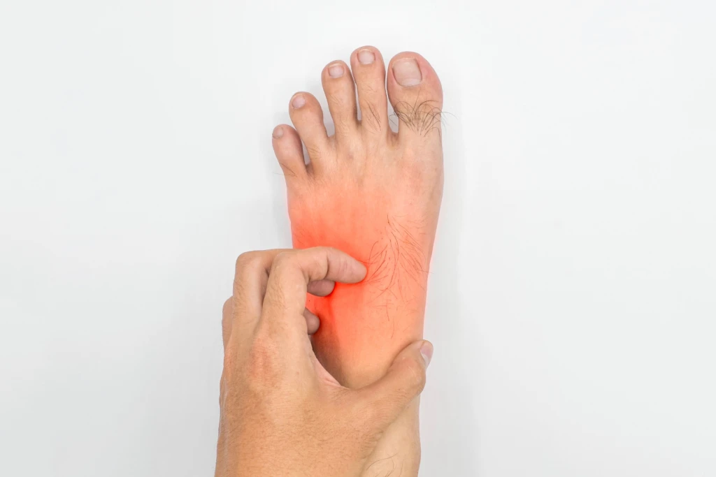 Person pressing a hand against the reddened midfoot area, indicating midfoot pain.