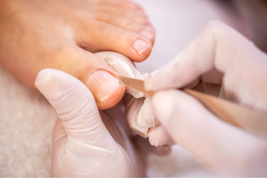 Gloved hands working on the cuticle at the base of a big toenail with a thin tool during a pedicure
