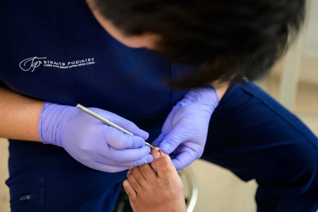 A Straits Podiatry podiatrist in gloves examining the corner of a patient's big toenail with a sterile instrument