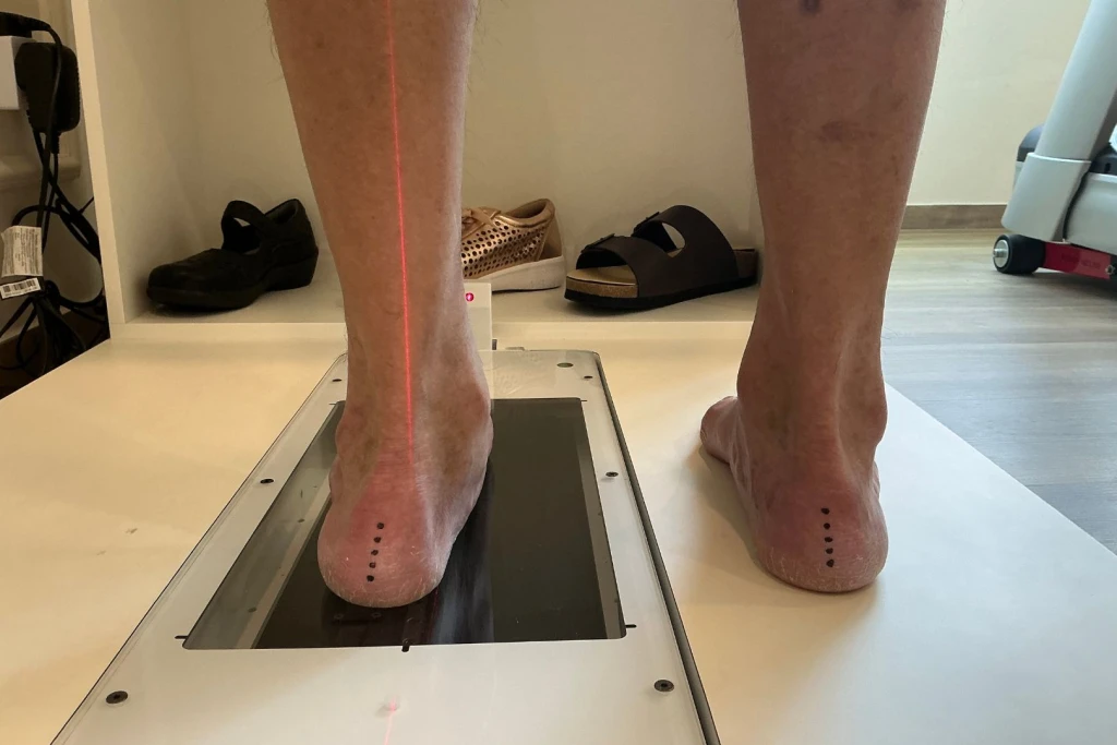 A rear view of a person's heels during a clinic foot-posture assessment, with a laser alignment line and markers checking for overpronation